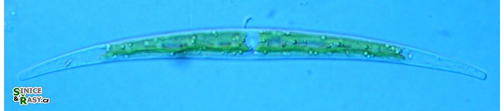 Closterium tumidum
