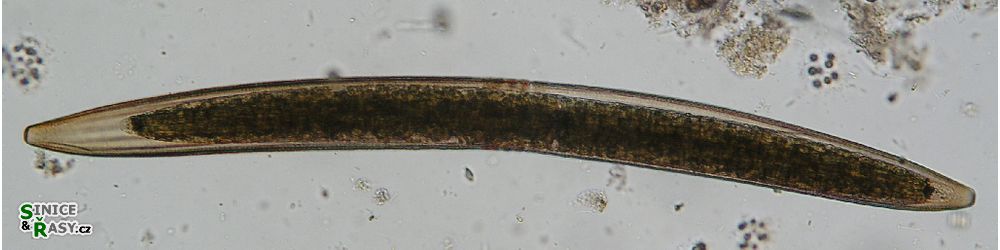 Closterium braunii
