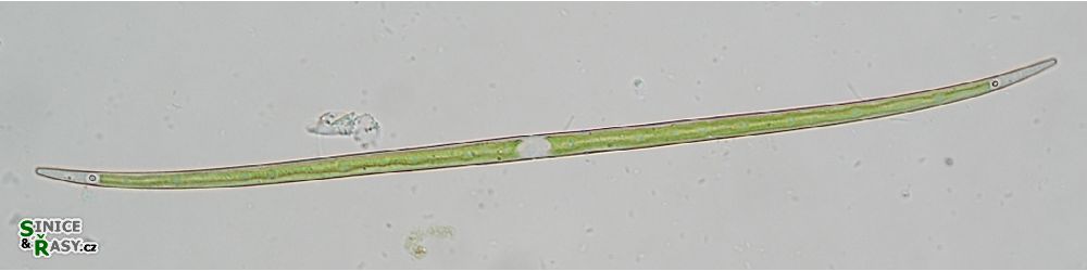 Closterium limneticum