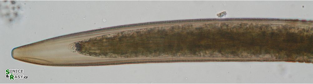 Closterium braunii