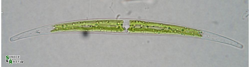 Closterium tumidum