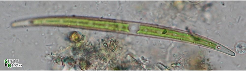 Closterium cornu