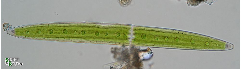 Closterium pritchardianum