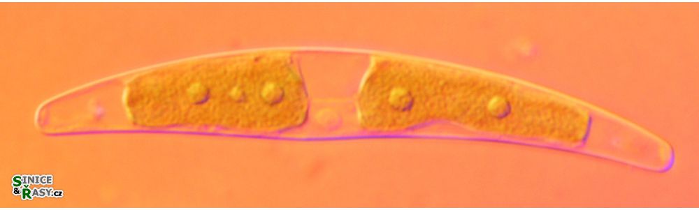 Closterium tumidum