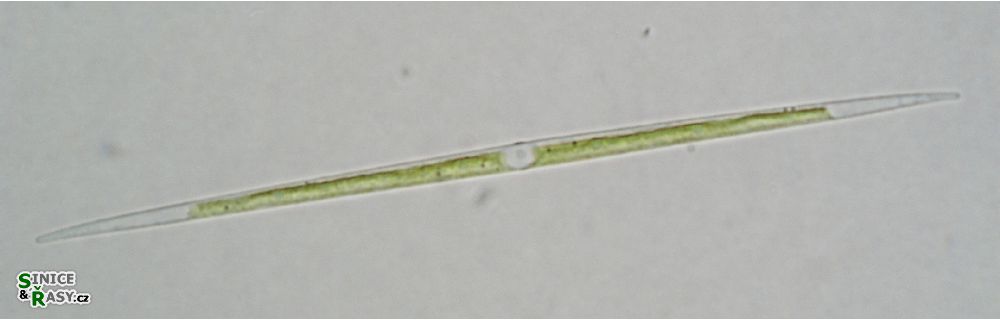 Closterium acutum