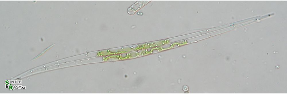 Closterium idiosporum