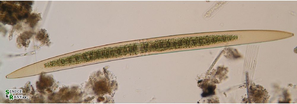 Closterium pritchardianum