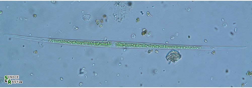 Closterium pronum