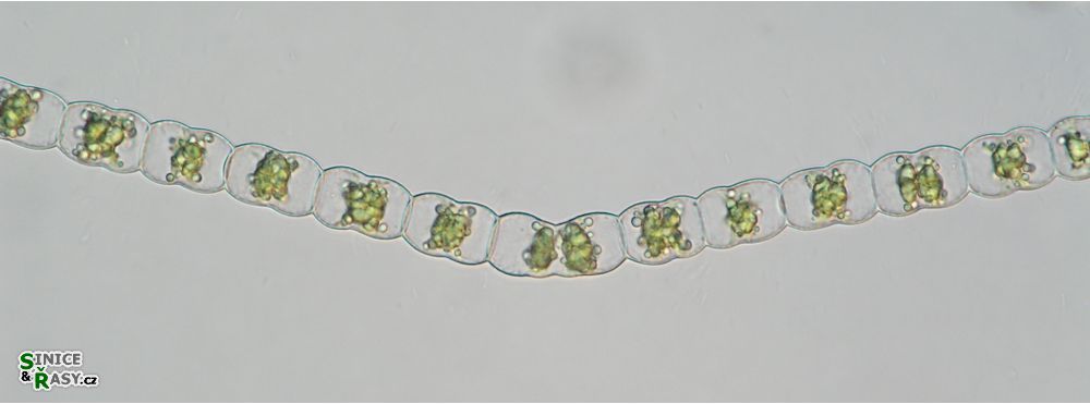Hyalotheca