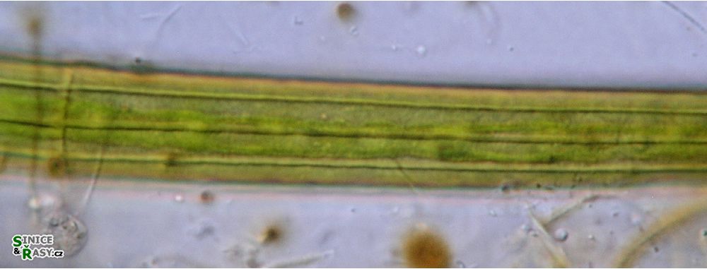 Closterium angustatum