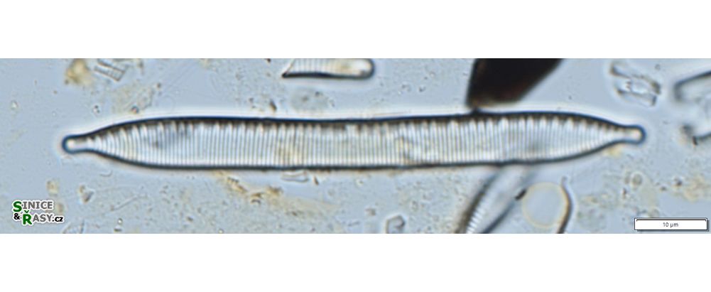 Hantzschia abundans