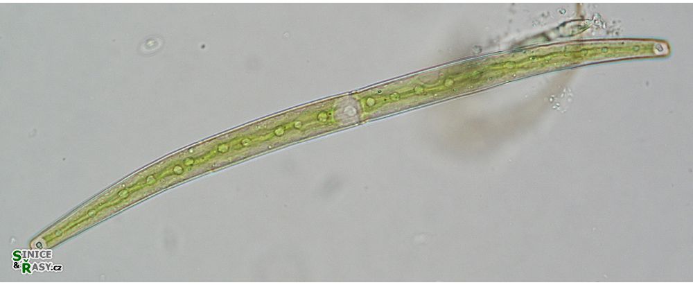 Closterium juncidum
