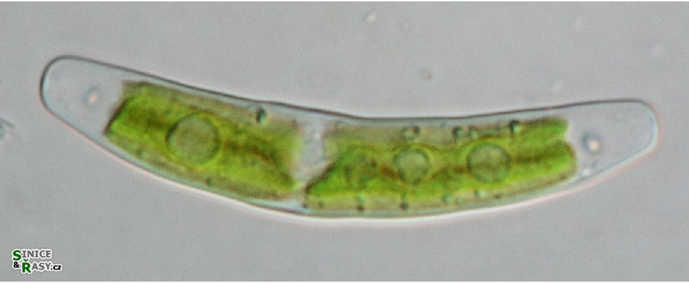 Closterium pusillum