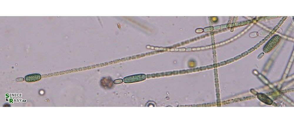 Cylindrospermum stagnale