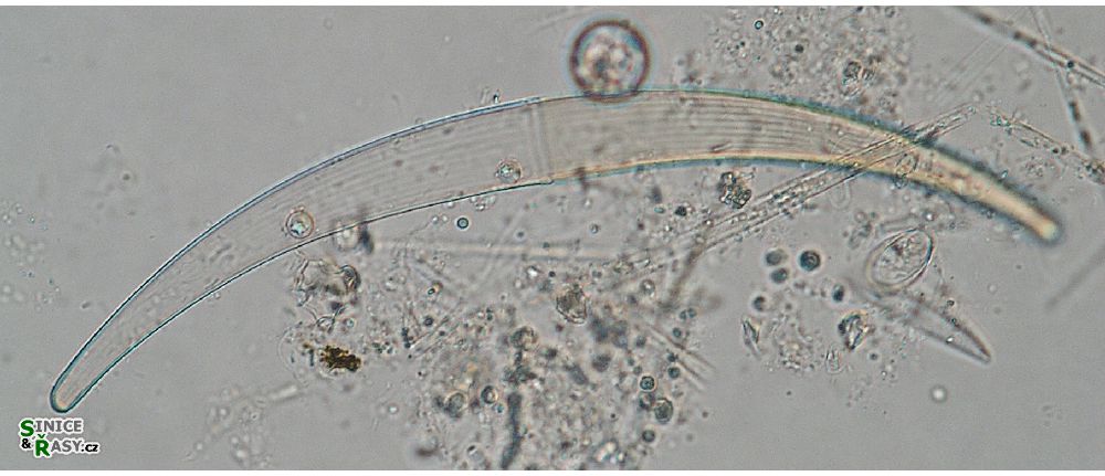 Closterium nematodes
