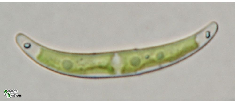 Closterium pseudopygmaeum