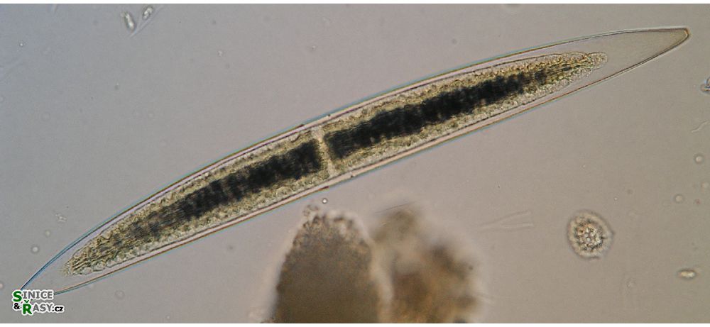 Closterium acerosum