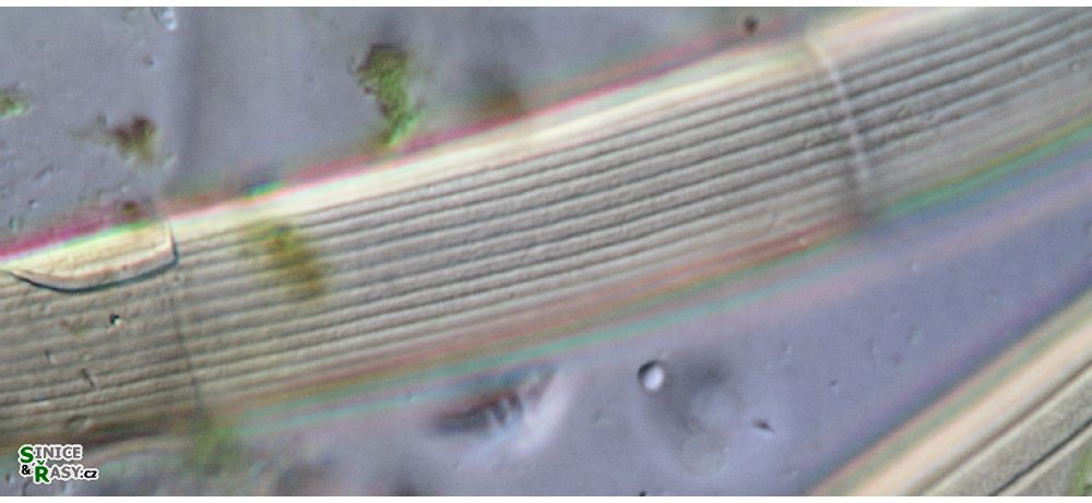 Closterium intermedium