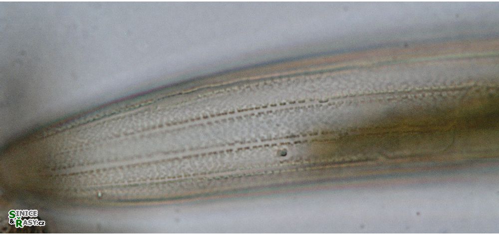 Closterium braunii