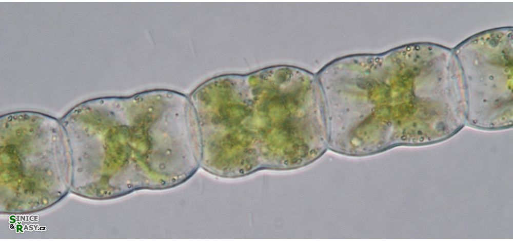 Hyalotheca