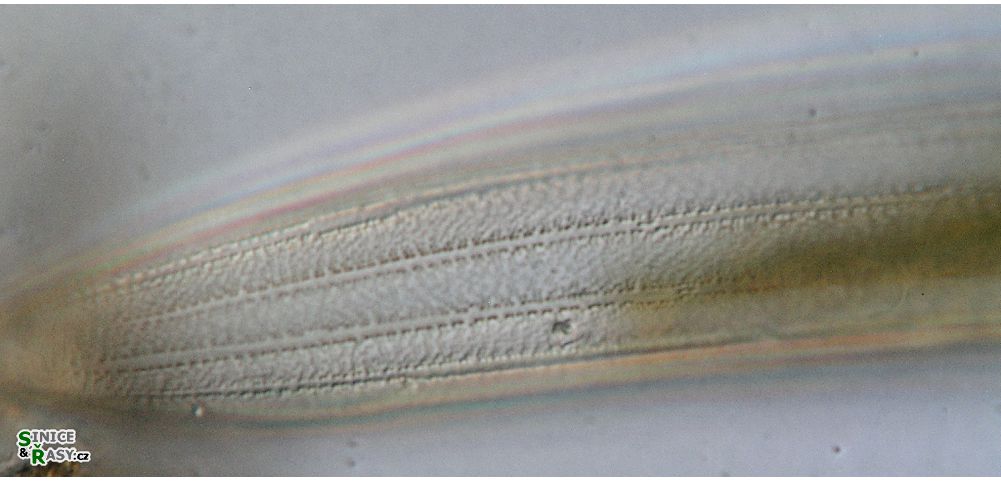 Closterium braunii
