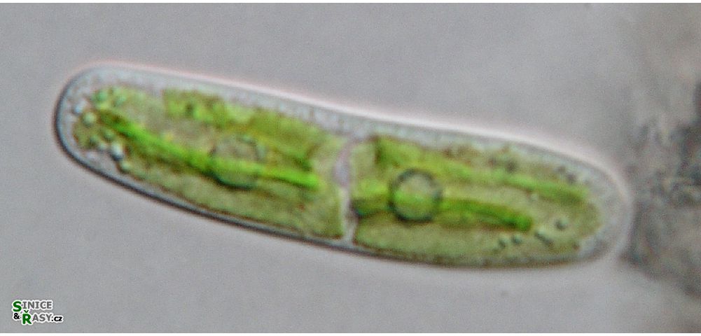 Closterium pusillum