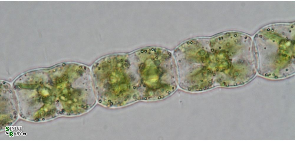 Hyalotheca