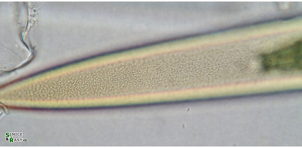 Closterium pritchardianum