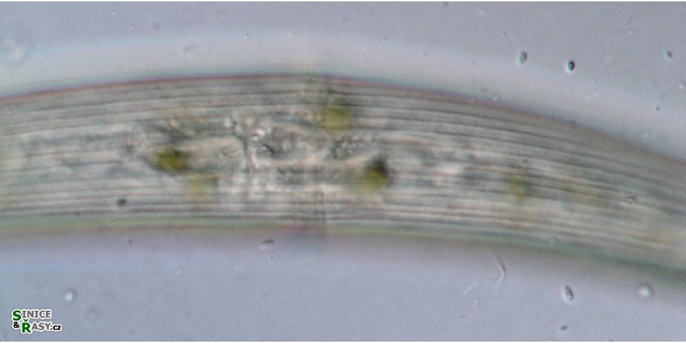 Closterium
