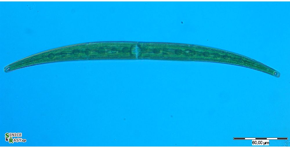 Closterium intermedium