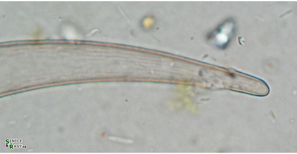 Closterium archerianum