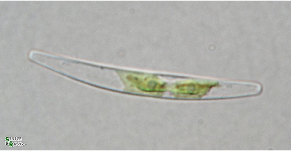 Closterium cornu