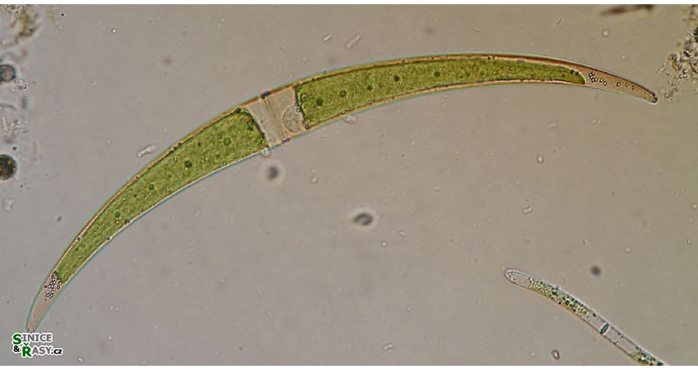 Closterium dianae