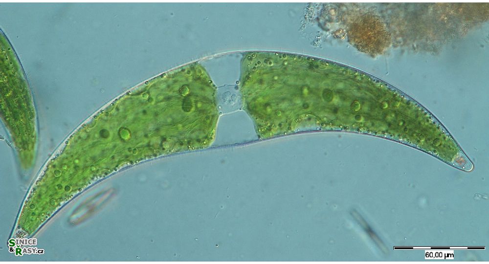 Closterium moniliferum