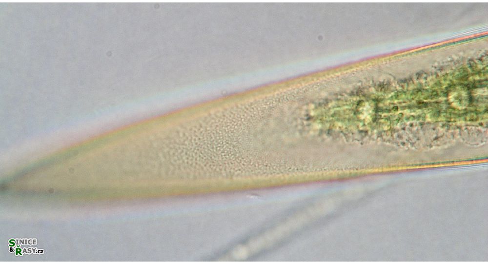Closterium pritchardianum