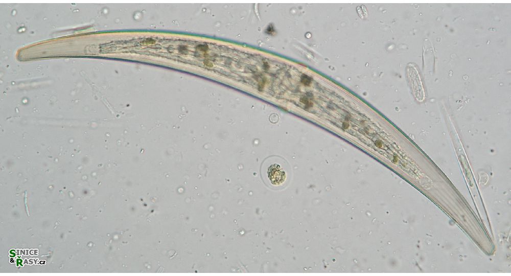 Closterium