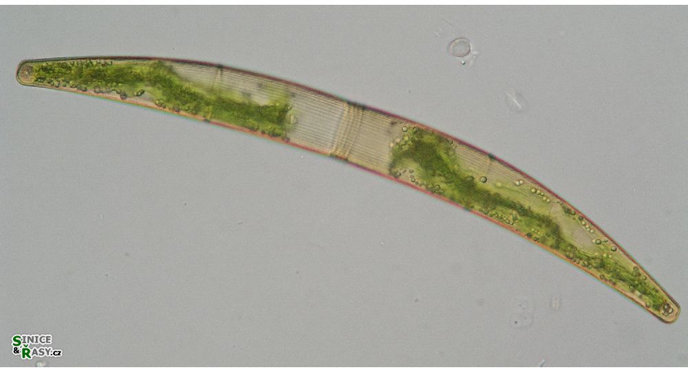 Closterium striolatum