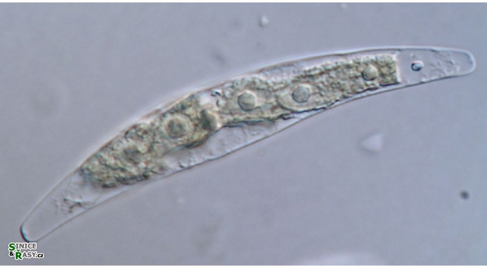 Closterium tumidum