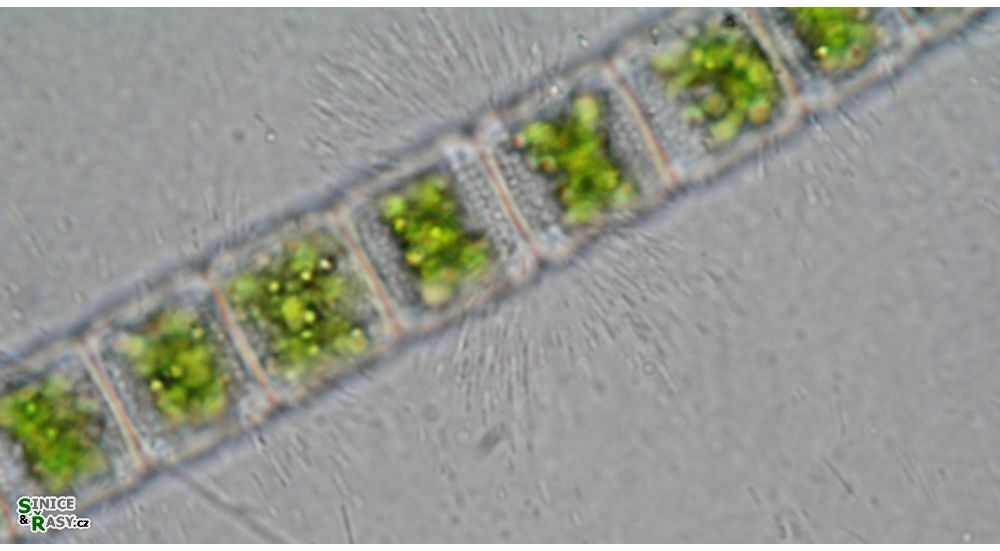 Hyalotheca mucosa