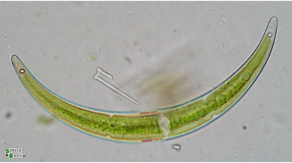 Closterium archerianum