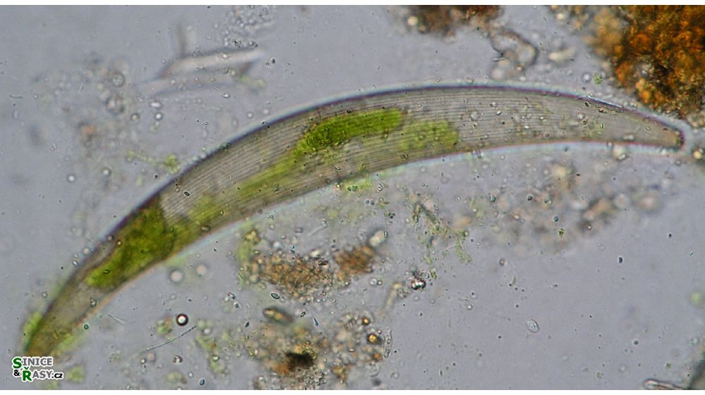 Closterium costatum