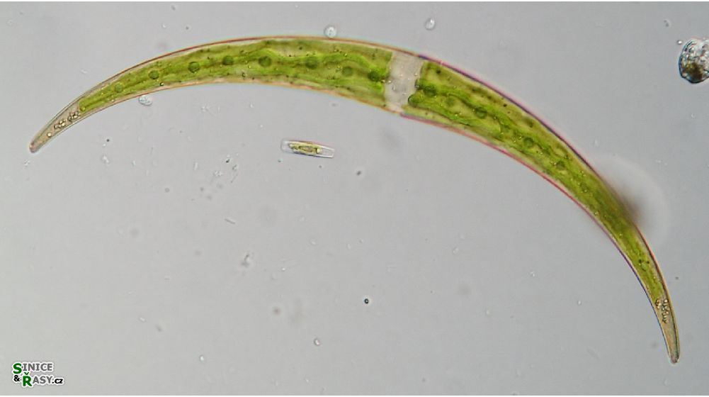 Closterium dianae