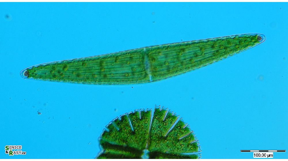 Closterium lunula