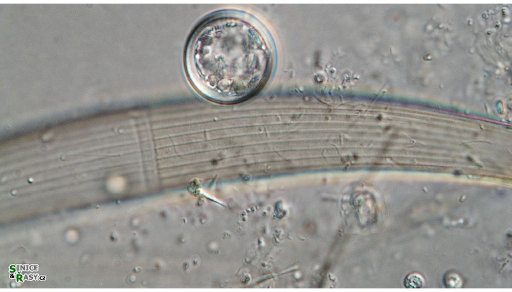 Closterium nematodes