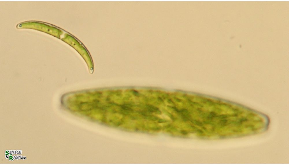 Closterium pseudopygmaeum