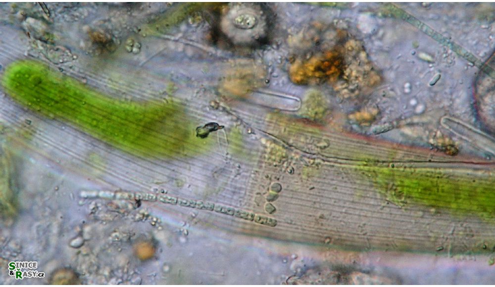 Closterium costatum