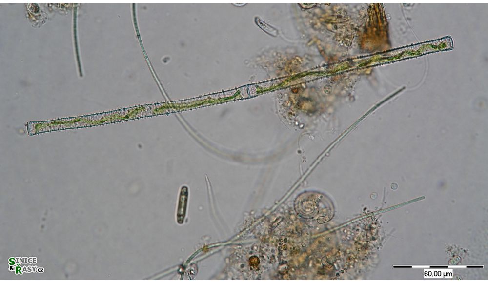 Gonatozygon aculeatum