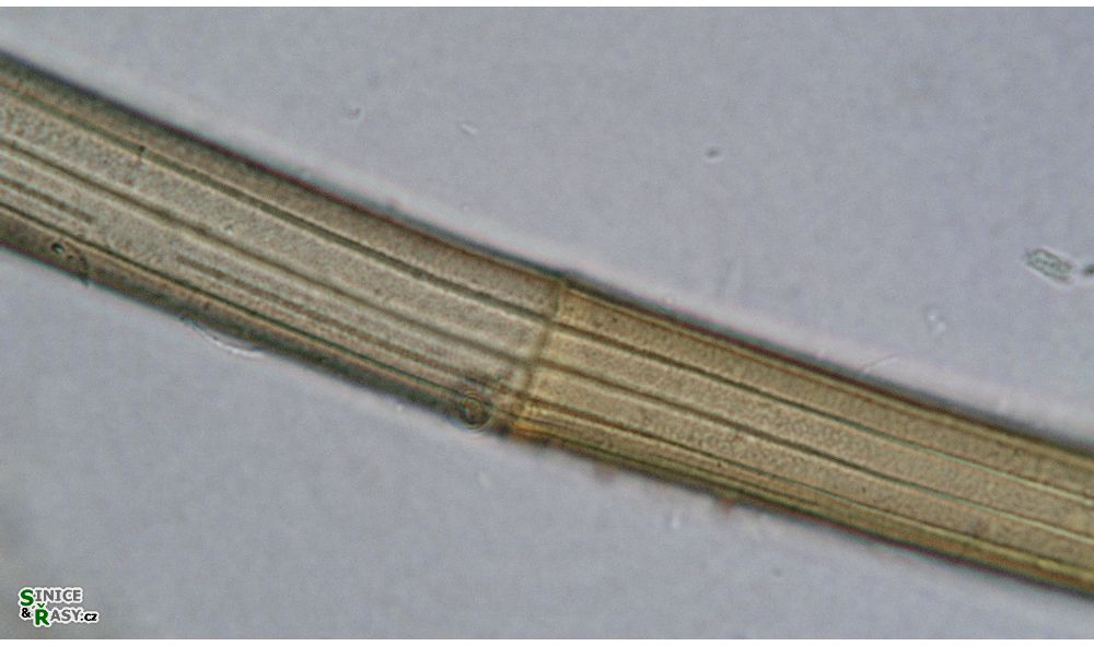 Closterium angustatum