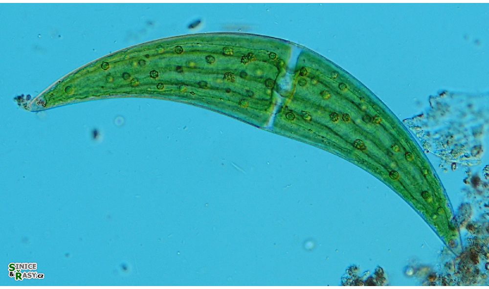 Closterium ehrenbergii