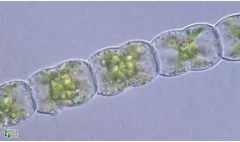 Hyalotheca